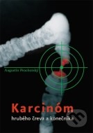 Karcinóm hrubého čreva a konečníka - cena, srovnání