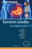 Karcinom žaludku - cena, srovnání