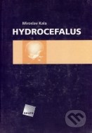 Hydrocefalus - cena, srovnání
