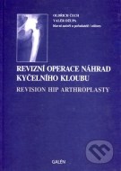 Revizní operace náhrad kyčelního kloubu - cena, srovnání