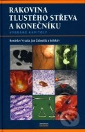 Rakovina tlustého střeva a konečníku - cena, srovnání
