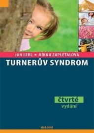 Turnerův syndrom