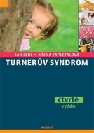 Turnerův syndrom - cena, srovnání