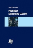Prognóza karcinomu ledviny - cena, srovnání