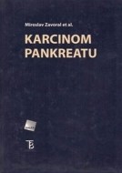 Karcinom pankreatu - cena, srovnání