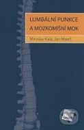Lumbální punkce a mozkomíšní mok - cena, srovnání
