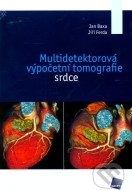 Multidetektorová výpočetní tomografie srdce - cena, srovnání