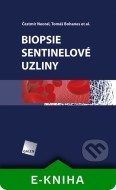 Biopsie sentinelové uzliny - cena, srovnání