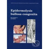 Epidermolysis bullosa congenita - cena, srovnání