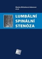 Lumbální spinální stenóza - cena, srovnání