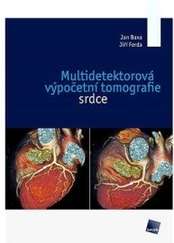 Multidetektorová výpočetní tomografie srdce