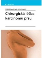 Chirurgická léčba karcinomu prsu - cena, srovnání