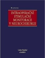 Intraoperační stimulační monitorace v neurochirurgii - cena, srovnání