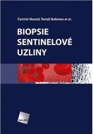 Biopsie sentinelové uzliny - cena, srovnání