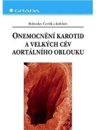 Onemocnění karotid a velkých cév aortálního oblouku - cena, srovnání