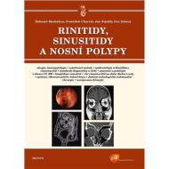 Rinitidy, sinusitidy a nosní polypy - cena, srovnání