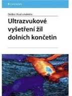 Ultrazvukové vyšetření žil dolních končetin - cena, srovnání