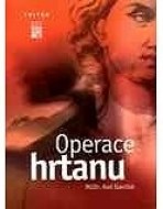 Operace hrtanu - cena, srovnání