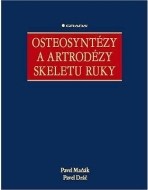 Osteosyntézy a artrodézy skeletu ruky - cena, srovnání