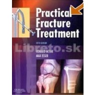 Practical Fracture Treatment - cena, srovnání