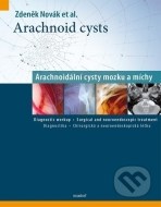 Arachnoid cysts - cena, srovnání