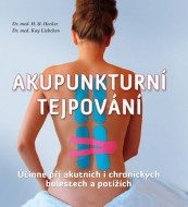 Akupunkturní tejpování - cena, srovnání