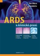 ARDS v klinické praxi - cena, srovnání