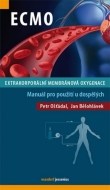 ECMO - Extrakorporální membránová oxygenace - cena, srovnání
