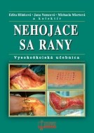 Nehojace sa rany - cena, srovnání