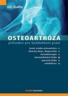 Osteoartróza - cena, srovnání