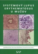Systémový lupus erythematosus u mužov - cena, srovnání
