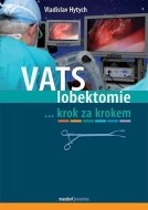 VATS lobektomie - cena, srovnání
