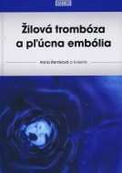 Žilová trombóza a pľúcna embólia - cena, srovnání