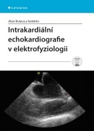 Intrakardiální echokardiografie v elektrofyziologii - cena, srovnání