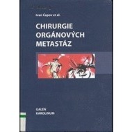 Chirurgie orgánových metastáz - cena, srovnání