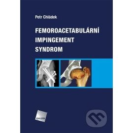 Femoroacetabulární impingement syndrom