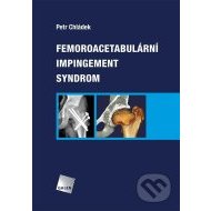 Femoroacetabulární impingement syndrom - cena, srovnání