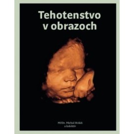 Tehotenstvo v obrazoch