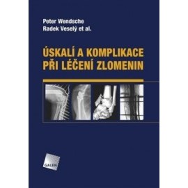 Úskalí a komplikace při léčení zlomenin