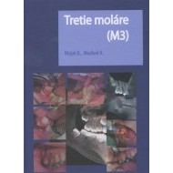 Tretie moláre (M3) - cena, srovnání