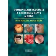 Otorinolaryngológia a chirurgia hlavy a krku - cena, srovnání