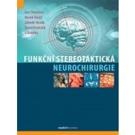 Funkční stereotaktická neurochirurgie - cena, srovnání