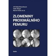 Zlomeniny proximálního femuru - cena, srovnání