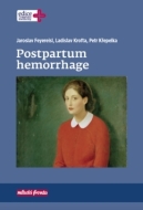 Postpartum hemorrhage - cena, srovnání