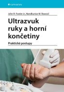 Ultrazvuk ruky a horní končetiny - cena, srovnání