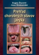Prehľad chorobných stavov jazyka - cena, srovnání