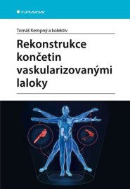 Rekonstrukce končetin vaskularizovanými laloky