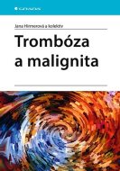 Trombóza a malignita - cena, srovnání