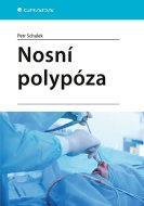 Nosní polypóza - cena, srovnání