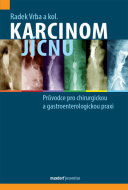 Karcinom jícnu - cena, srovnání